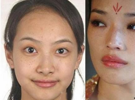 明星怎么祛雀斑,揭秘祛雀斑的明星护肤术